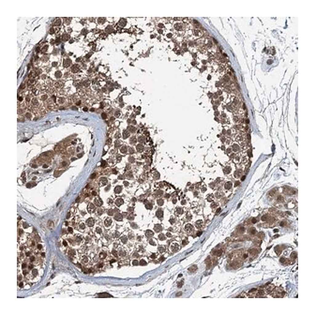 Merck Anti-UBXN6 antibody produced in rabbit