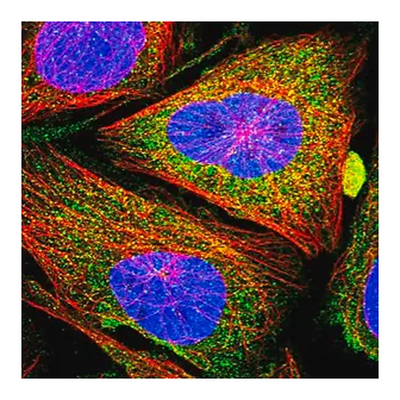 Merck Anti-CCBE1 antibody produced in rabbit