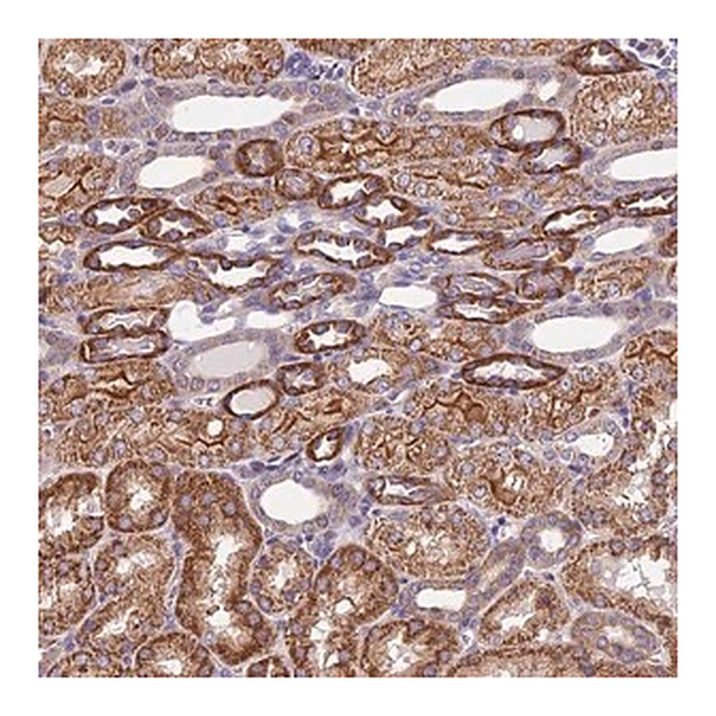 Merck Anti-TRMT1 antibody produced in rabbit