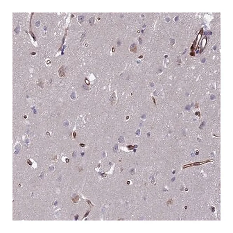 Merck Anti-C15orf59 antibody produced in rabbit