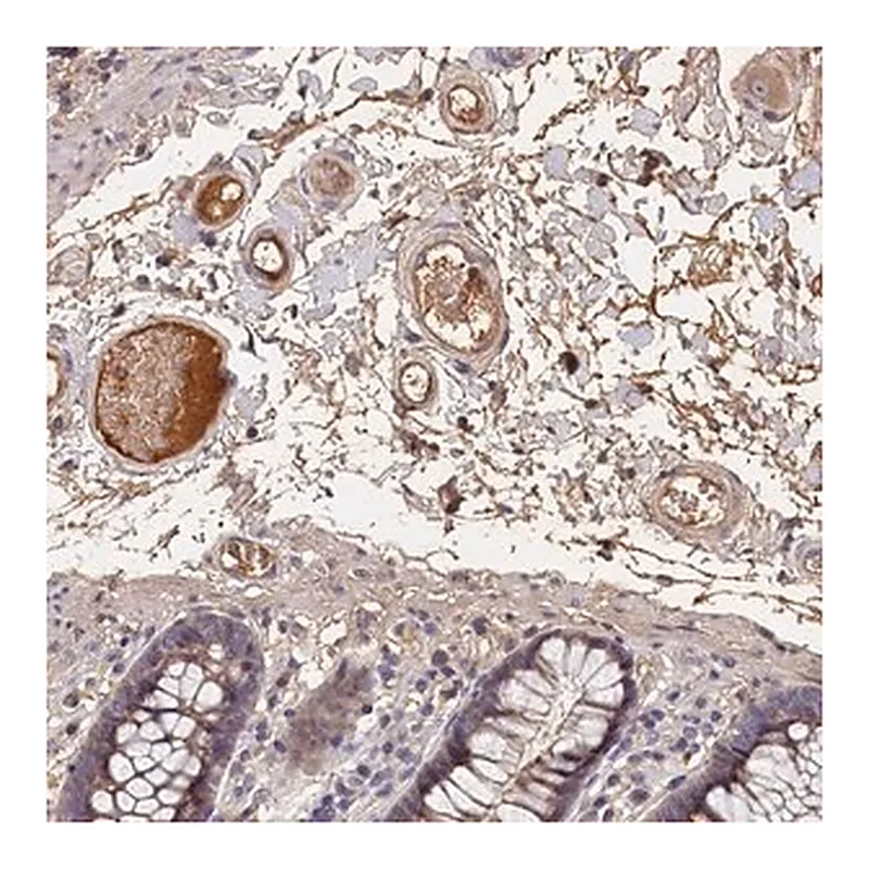 Merck Anti-ITIH1 antibody produced in rabbit