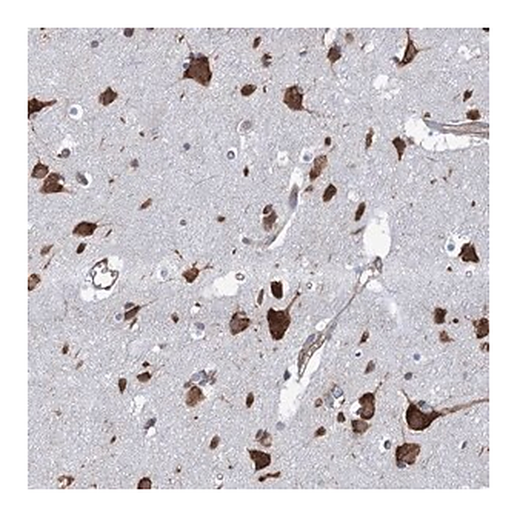 Merck Anti-SLC12A7 antibody produced in rabbit
