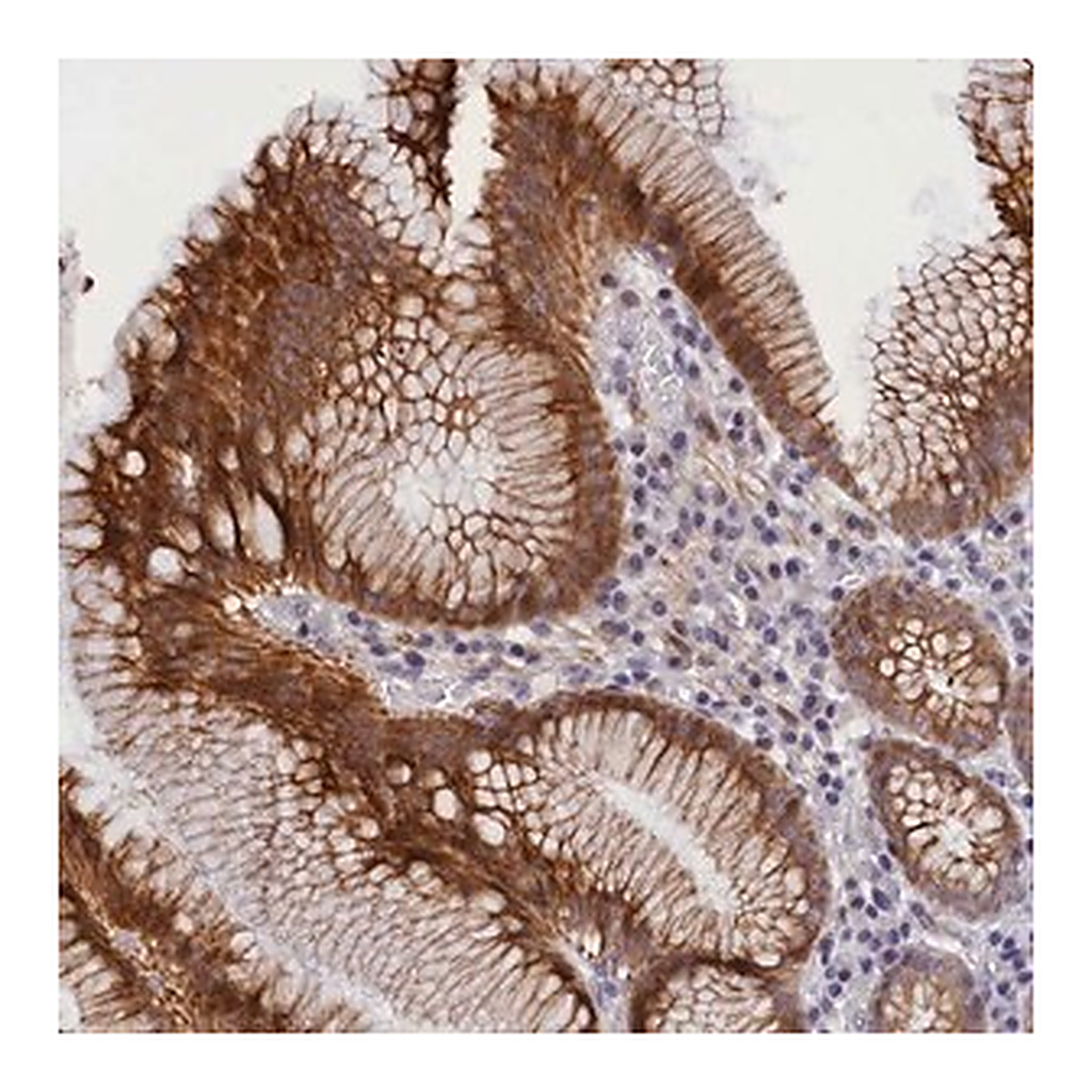 Merck Anti-ANKRD34B antibody produced in rabbit