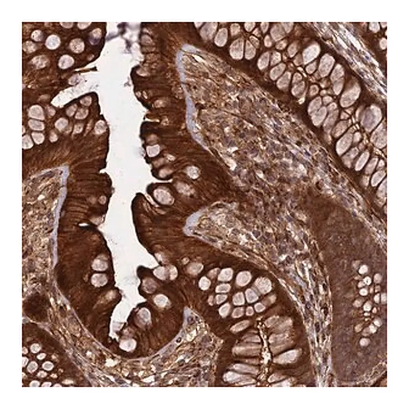 Merck Anti-PHLDB3 antibody produced in rabbit