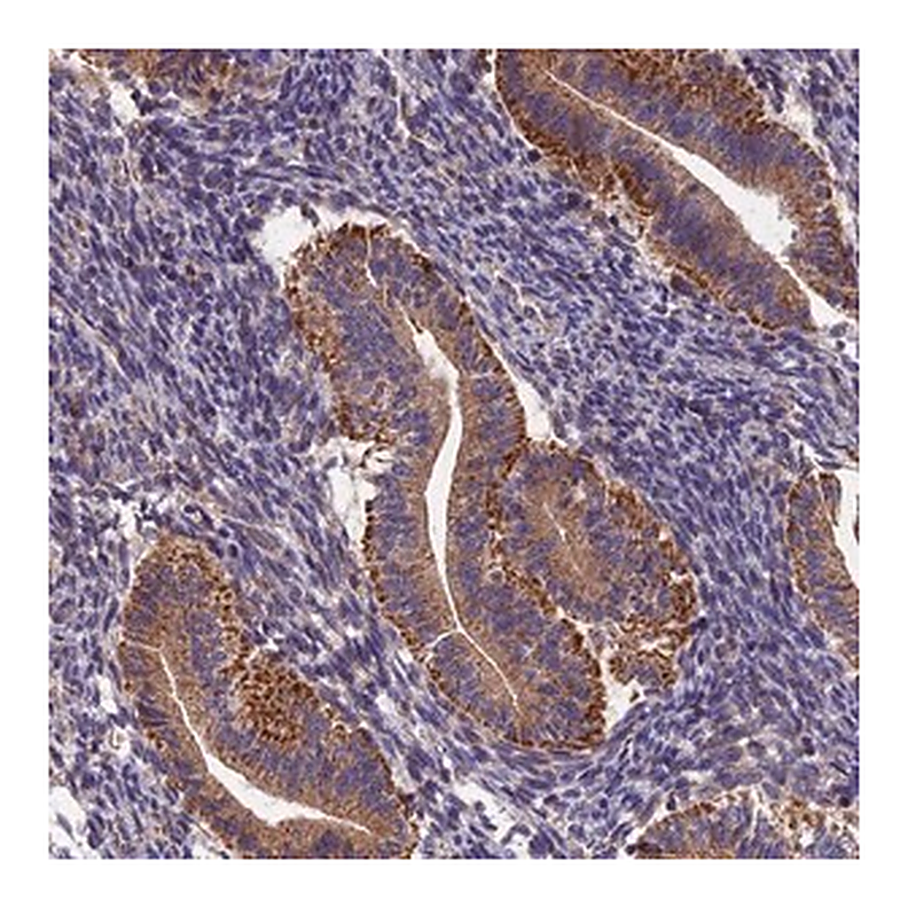 Merck Anti-RANBP6 antibody produced in rabbit
