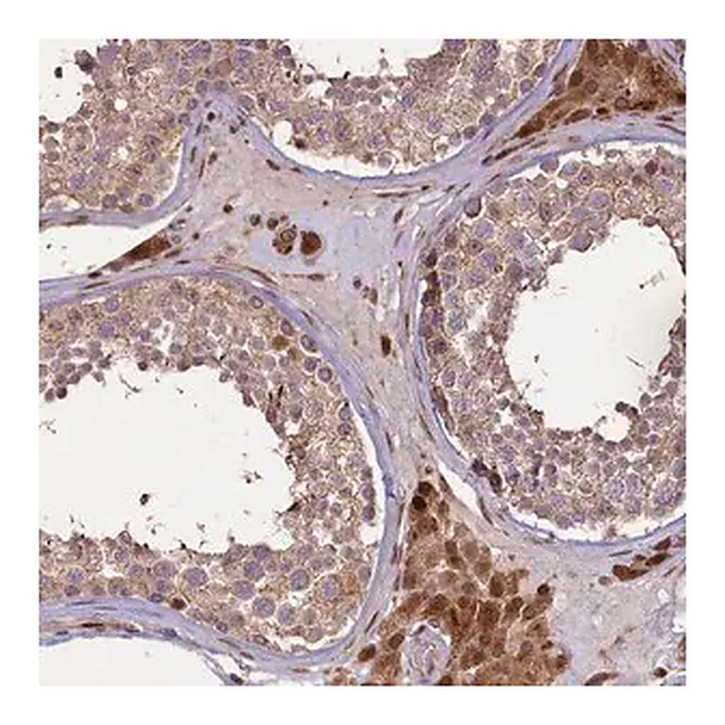 Merck Anti-SLC38A7 antibody produced in rabbit