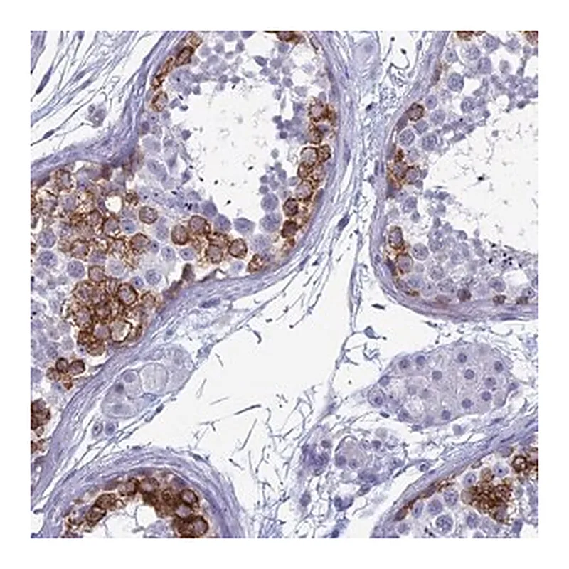 Merck Anti-MAGEB6 antibody produced in rabbit