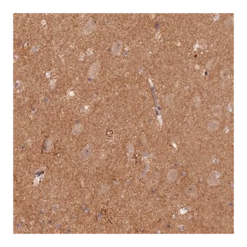 Merck Anti-GNB5 antibody produced in rabbit