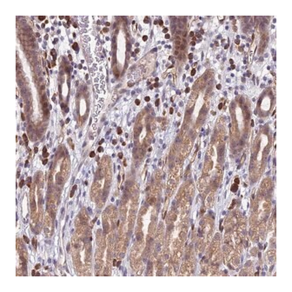 Merck Anti-PPP1R26 antibody produced in rabbit