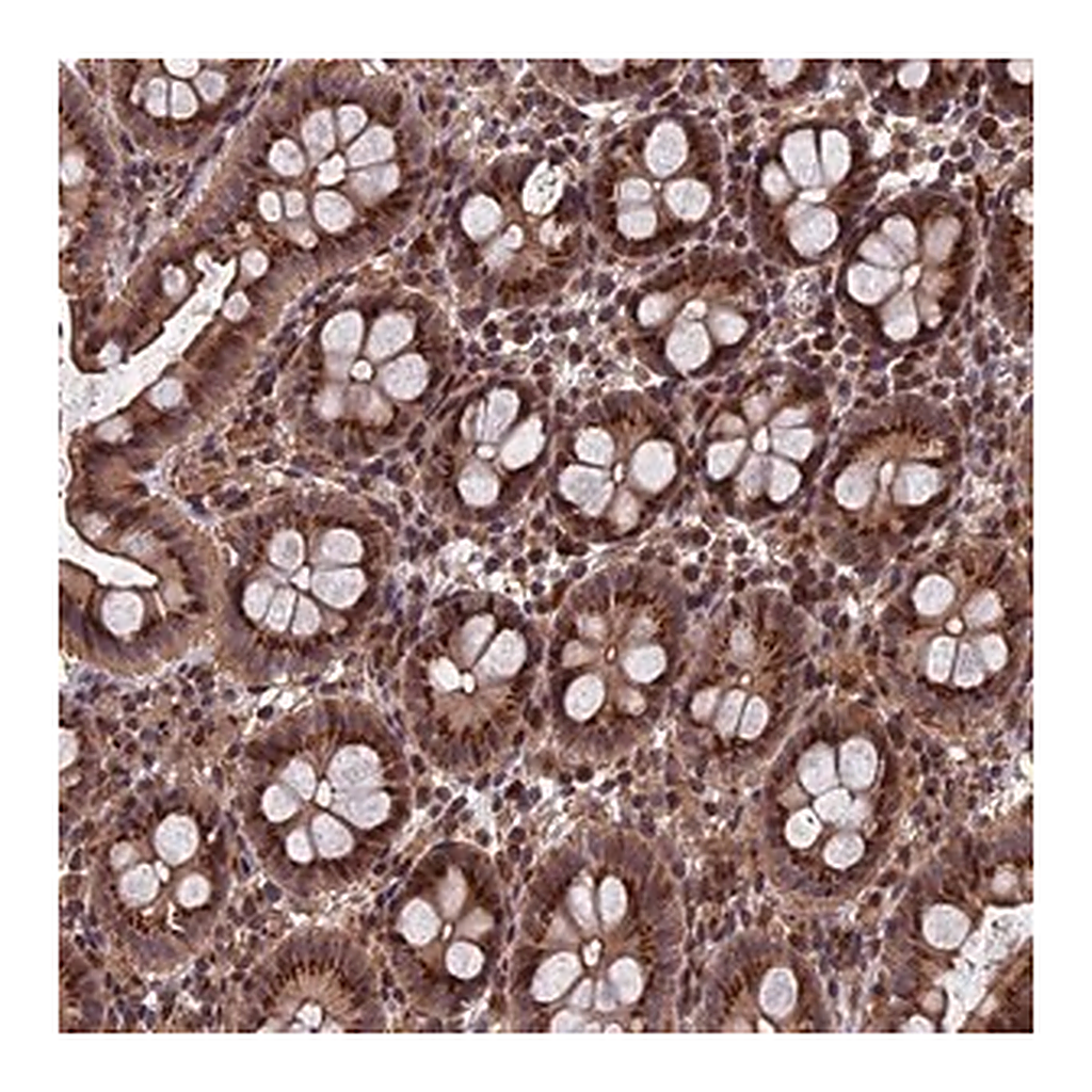 Merck Anti-RASGRF1 antibody produced in rabbit