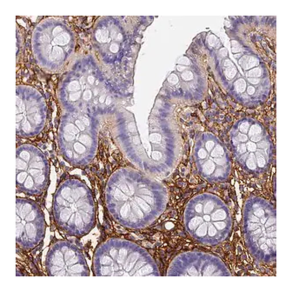 Merck Anti-ITIH1 antibody produced in rabbit