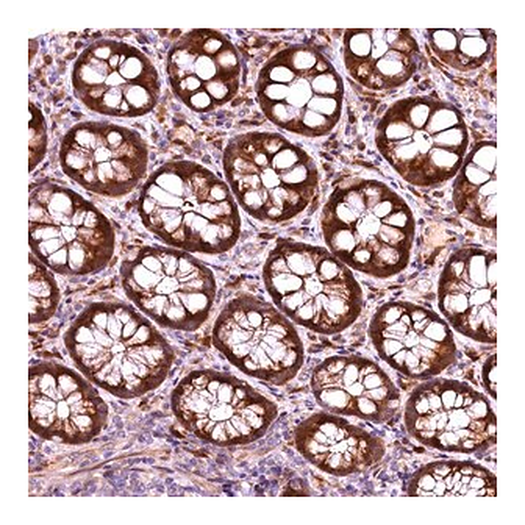 Merck Anti-RPUSD2 antibody produced in rabbit