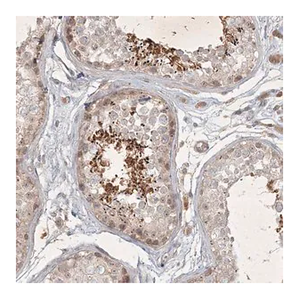 Merck Anti-BOD1 antibody produced in rabbit