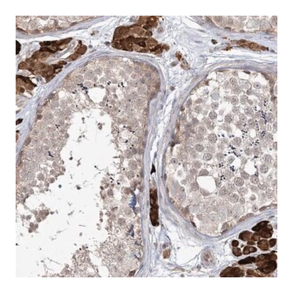 Merck Anti-CARD6 antibody produced in rabbit