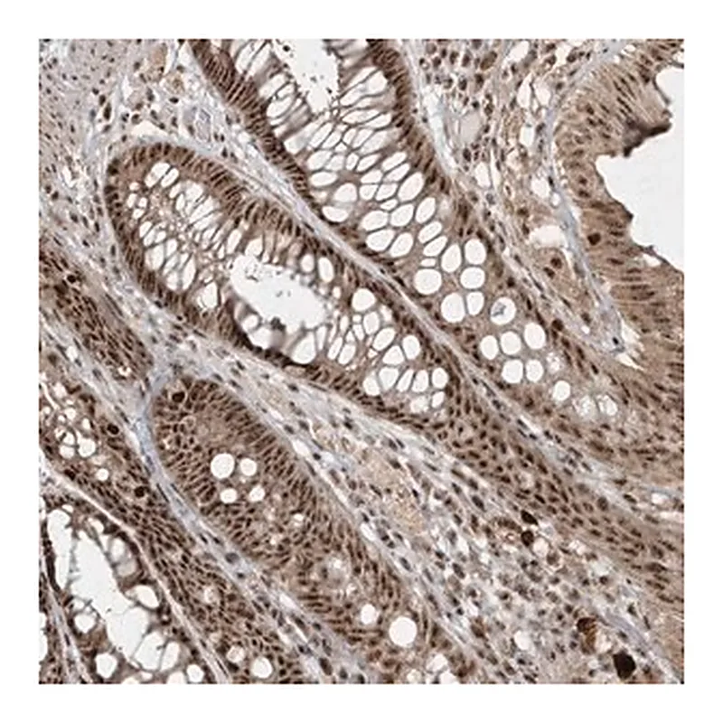Merck Anti-POLR3B antibody produced in rabbit