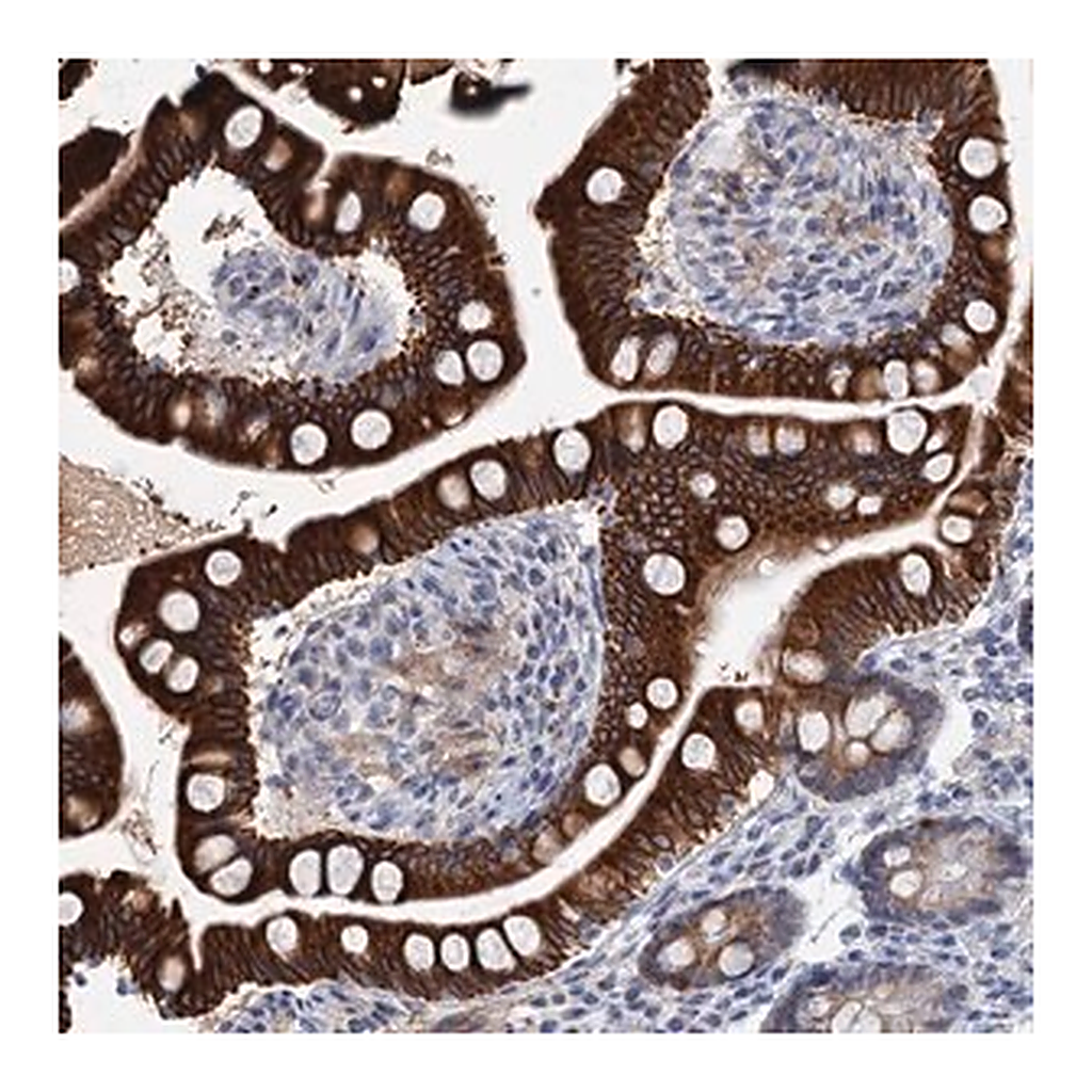 Merck Anti-ZNF527 antibody produced in rabbit