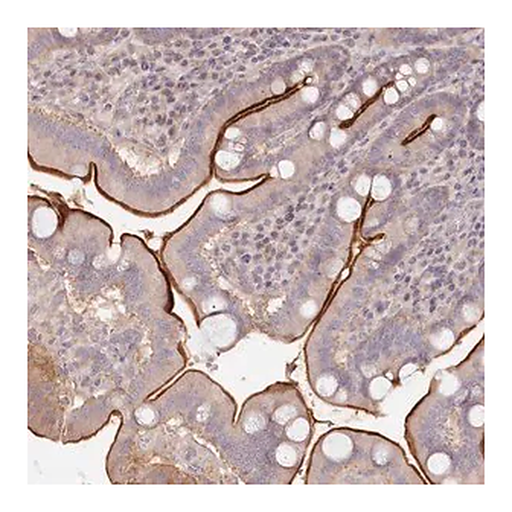Merck Anti-TCHP antibody produced in rabbit