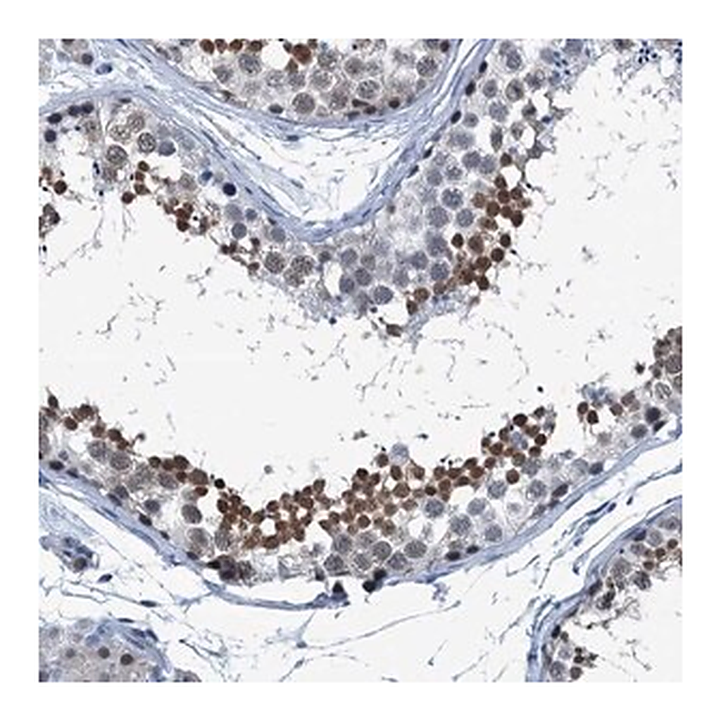 Merck Anti-TRPT1 antibody produced in rabbit