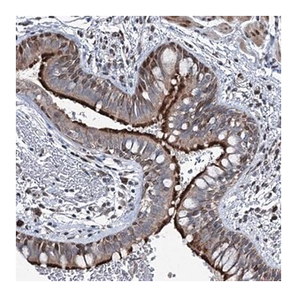 Merck Anti-MRPL14 antibody produced in rabbit