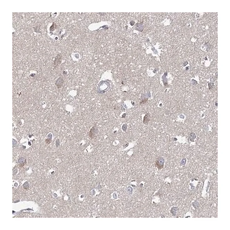 Merck Anti-ARHGAP44 antibody produced in rabbit