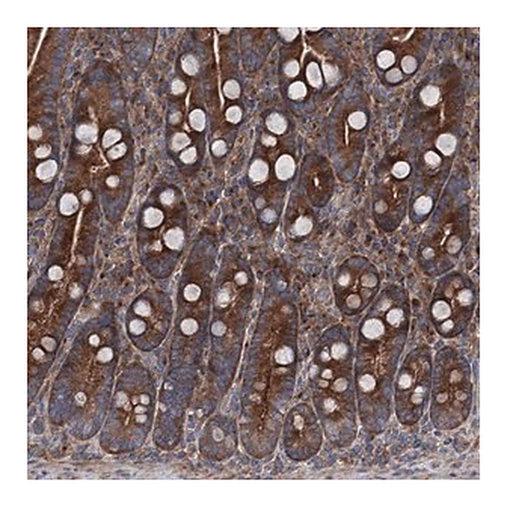 Merck Anti-RUFY1 antibody produced in rabbit