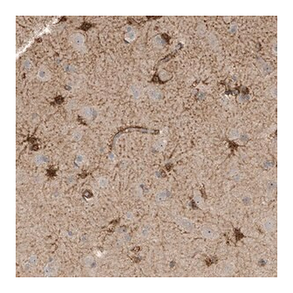 Merck Anti-SLFN14 antibody produced in rabbit