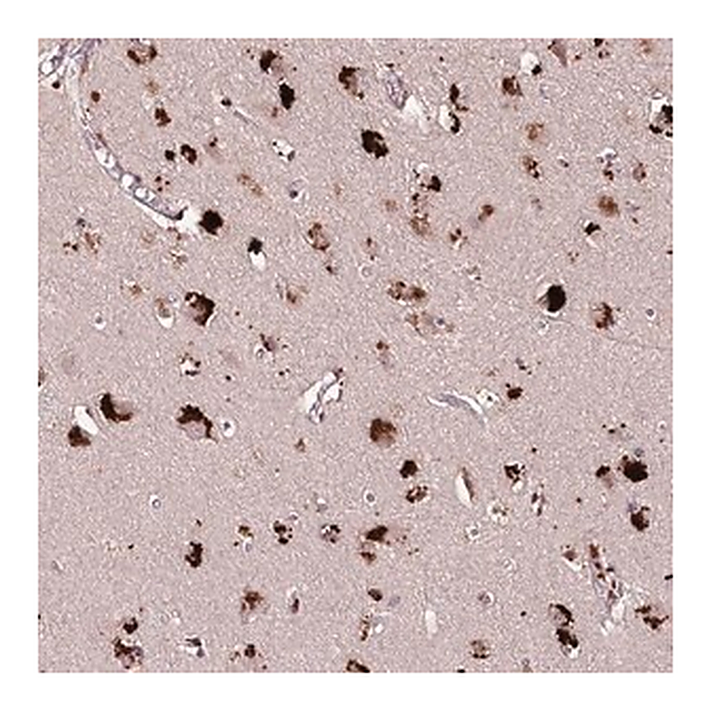 Merck Anti-CARD19 antibody produced in rabbit