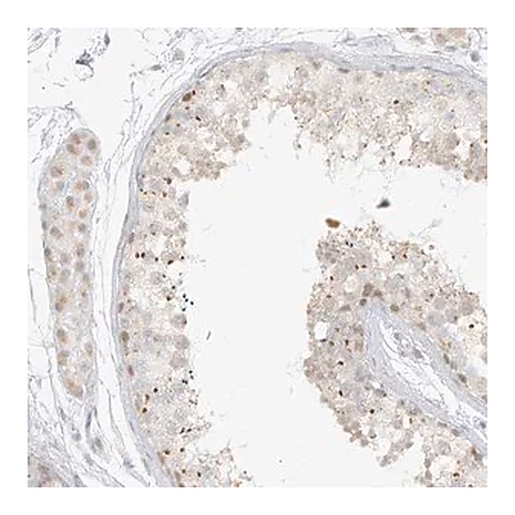 Merck Anti-DYRK1B antibody produced in rabbit