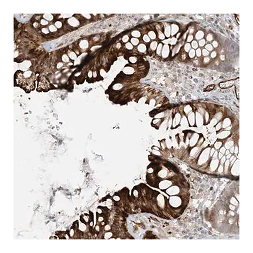 Merck Anti-BCORL1 antibody produced in rabbit