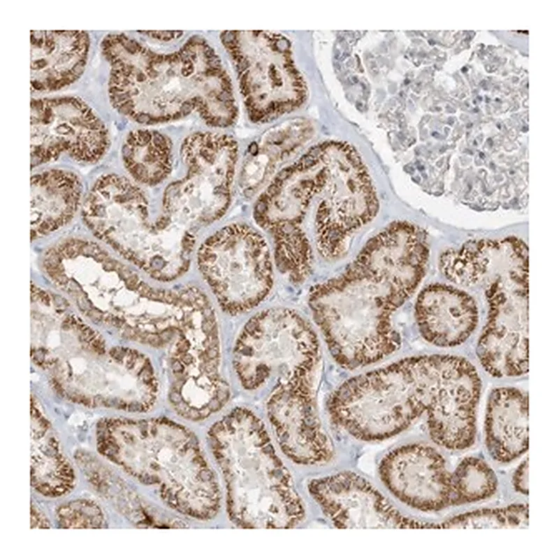 Merck Anti-UHRF1BP1 antibody produced in rabbit