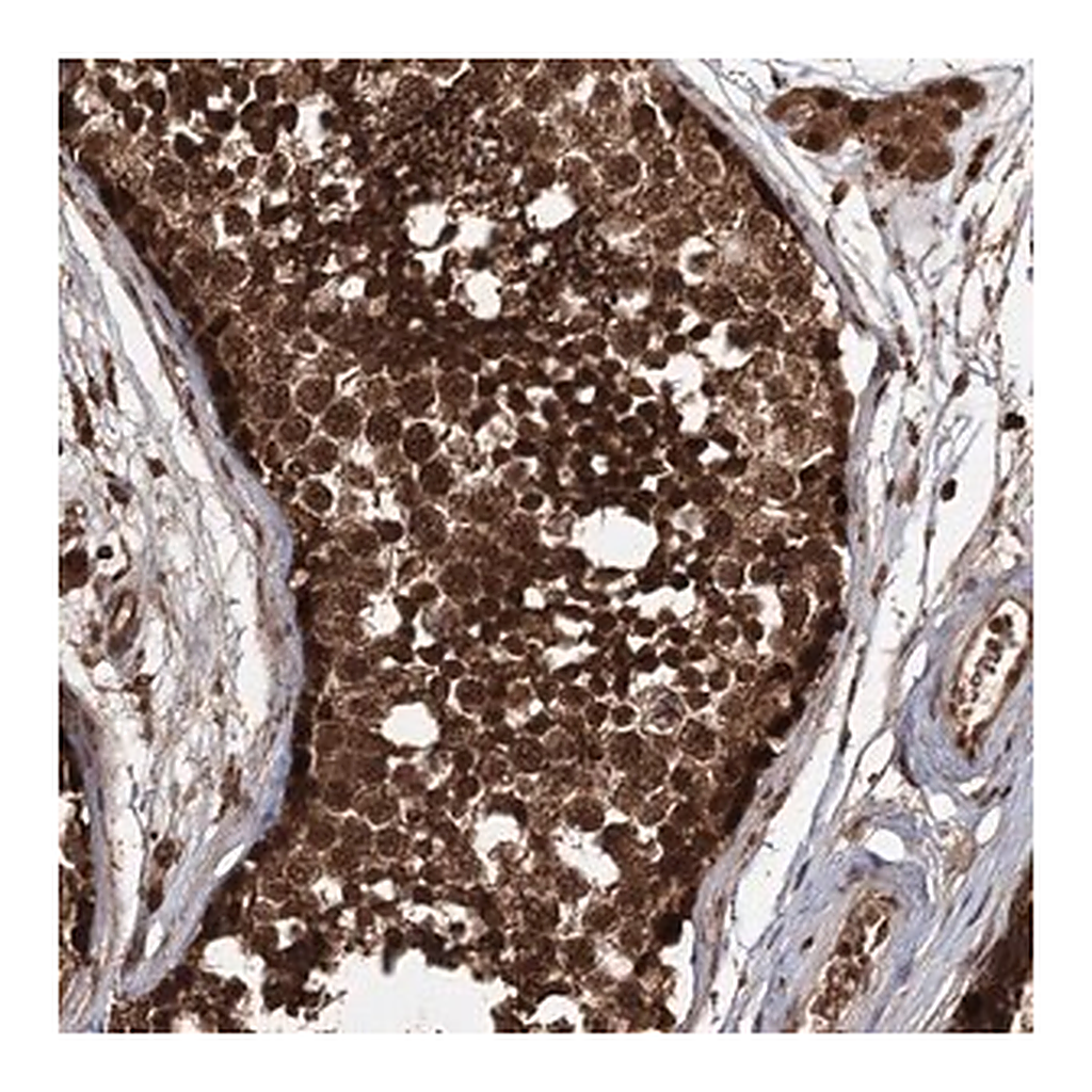Merck Anti-FBXO7 antibody produced in rabbit