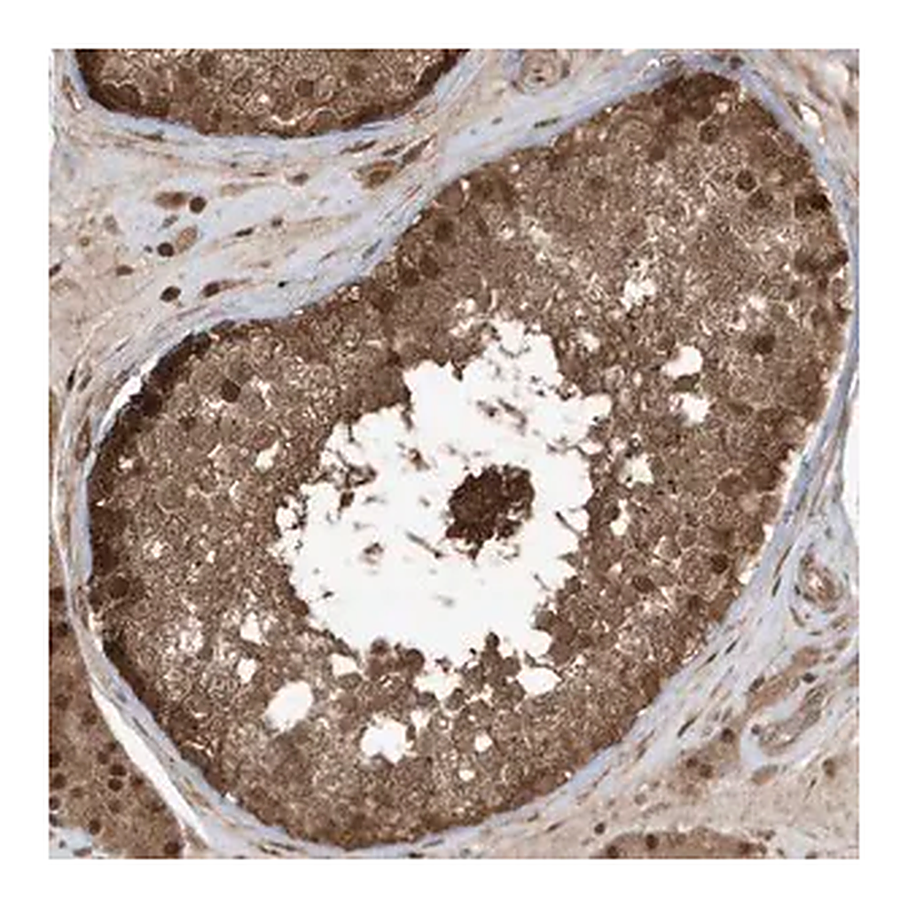 Merck Anti-MAPK1IP1L antibody produced in rabbit