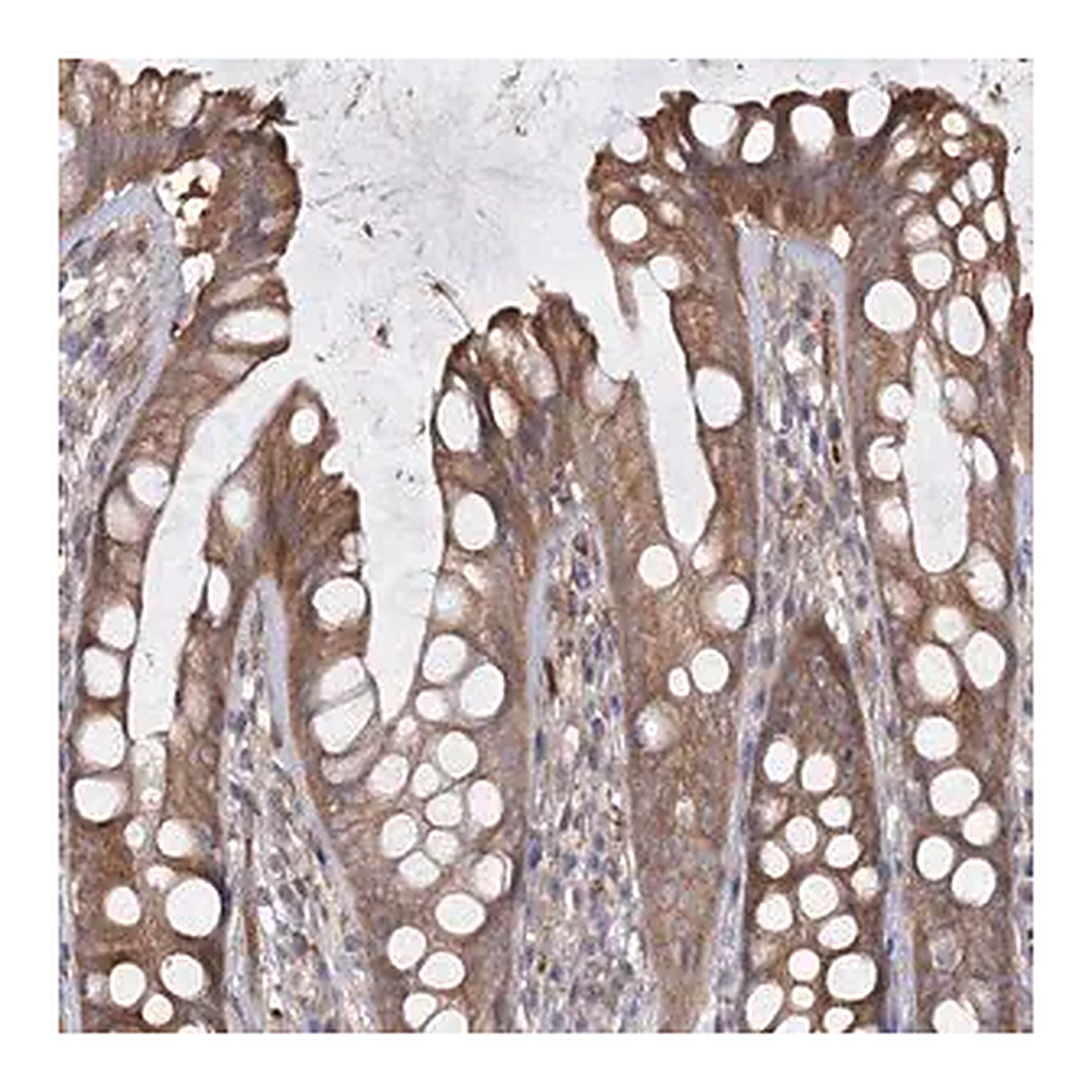 Merck Anti-RIN2 antibody produced in rabbit