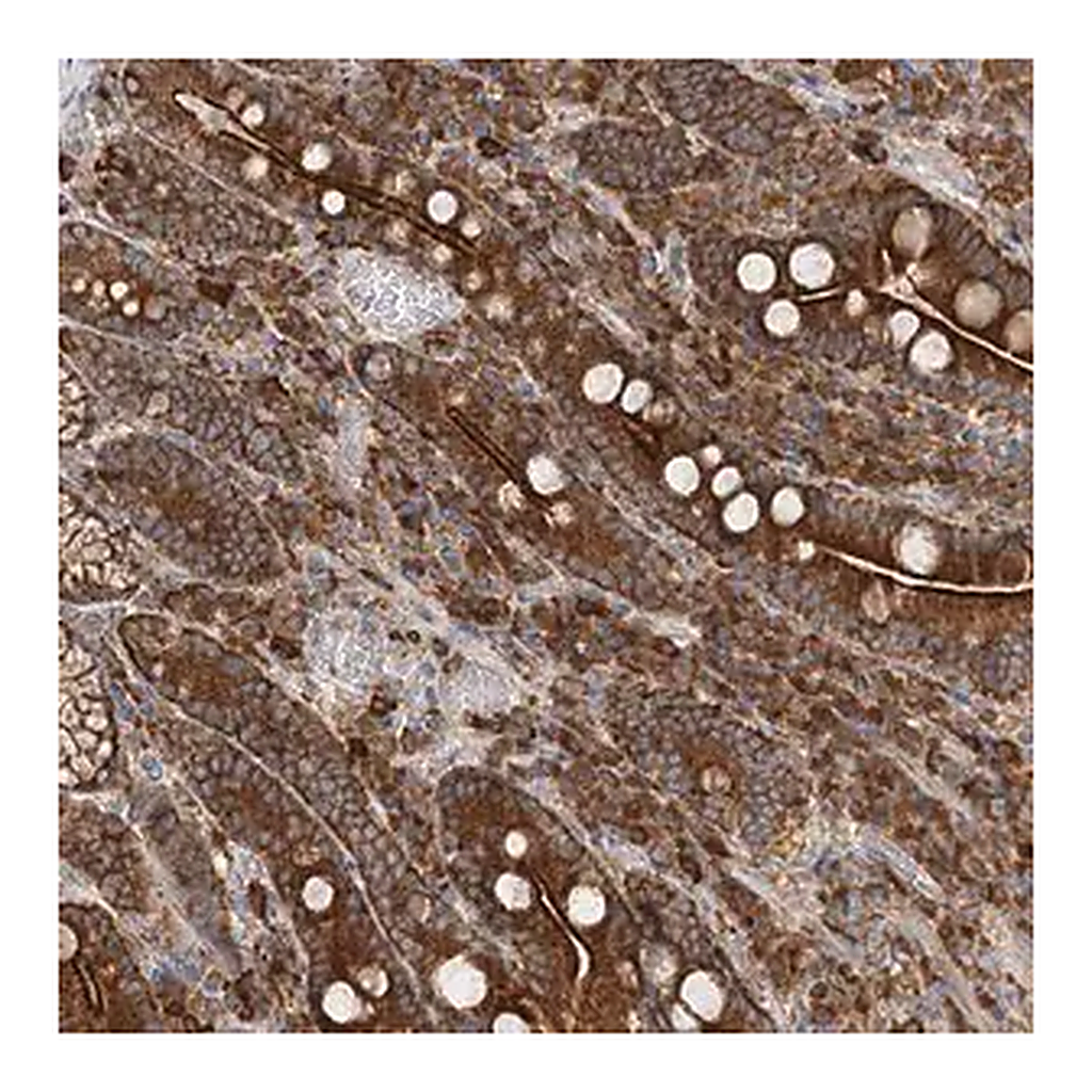 Merck Anti-TAS1R1 antibody produced in rabbit