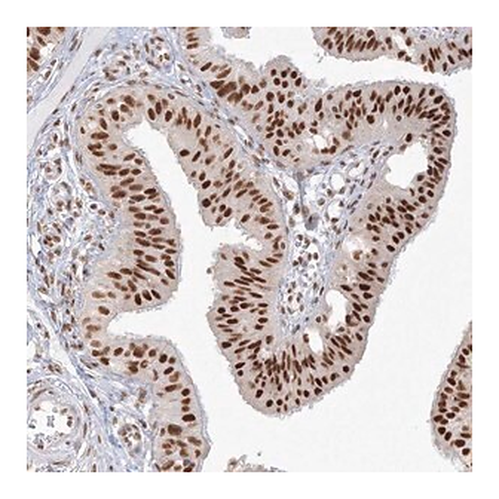 Merck Anti-PPP4R2 antibody produced in rabbit