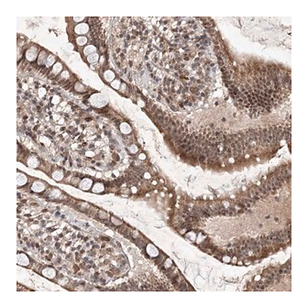 Merck Anti-C3orf38 antibody produced in rabbit