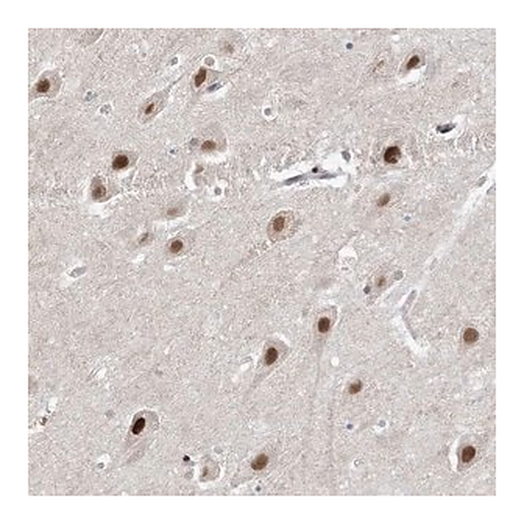 Merck Anti-WAC antibody produced in rabbit
