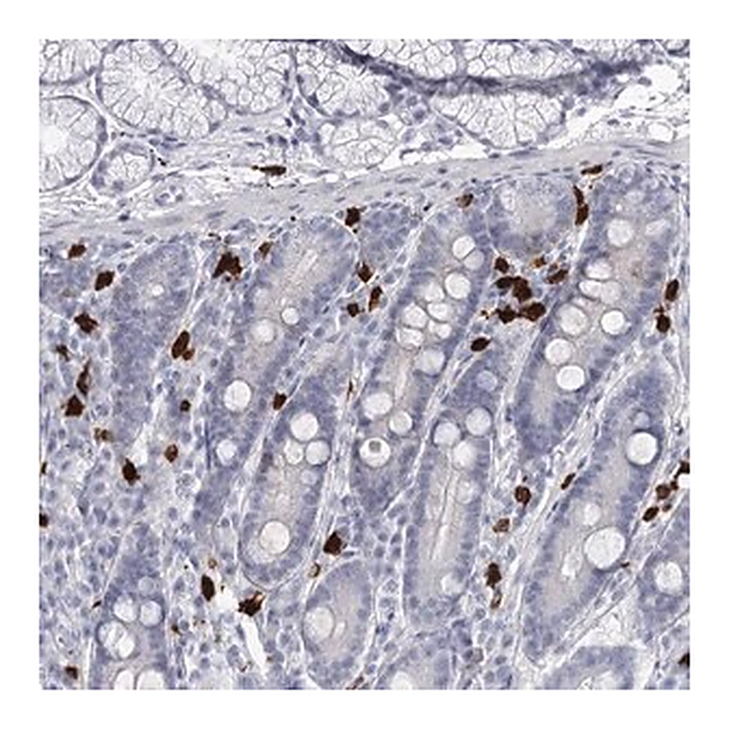 Merck Anti-CFAP58 antibody produced in rabbit