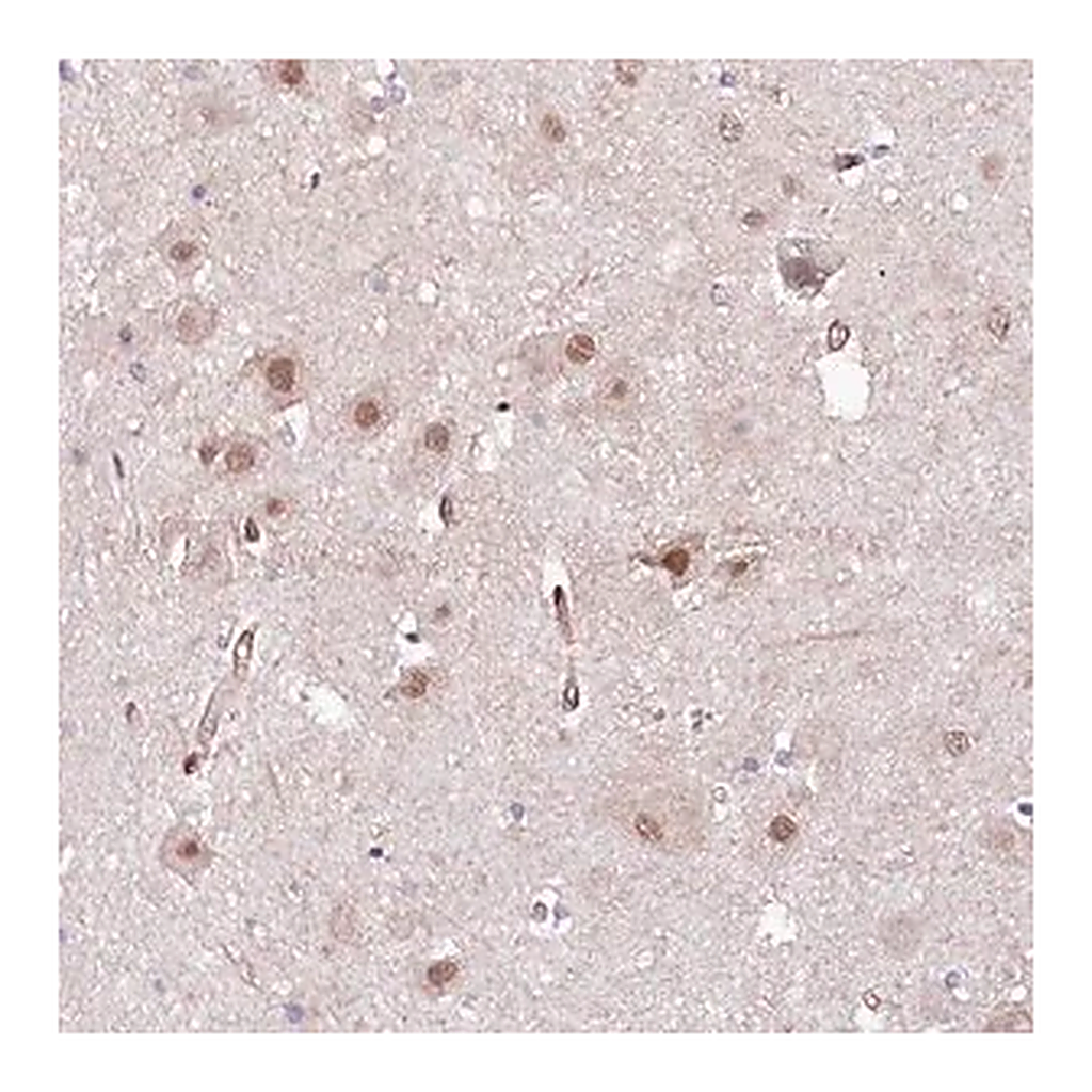 Merck Anti-PPP2R5B antibody produced in rabbit