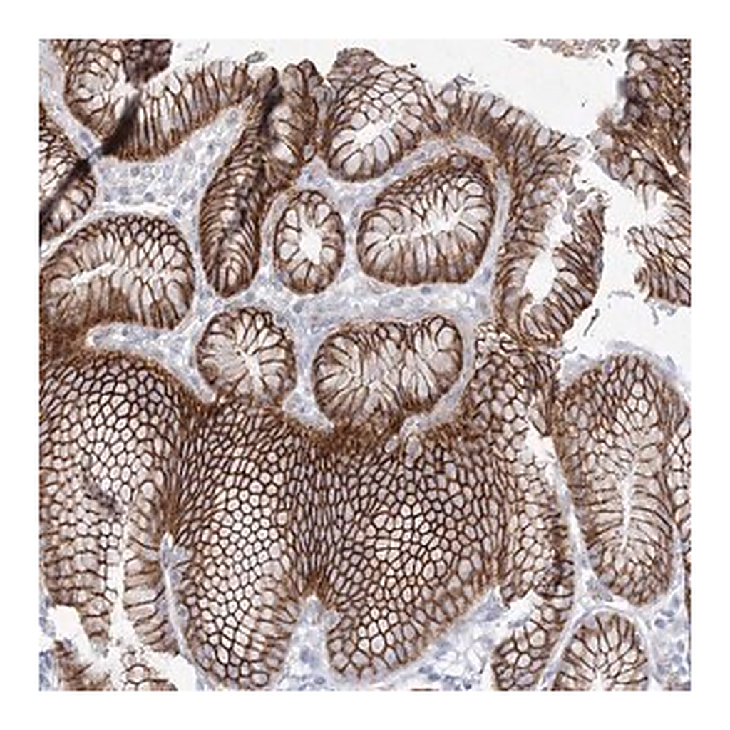 Merck Anti-NAA40 antibody produced in rabbit