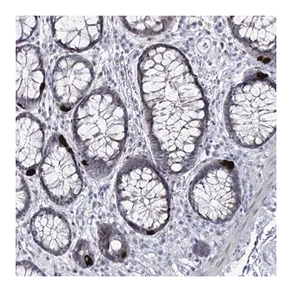 Merck Anti-RBM15B antibody produced in rabbit