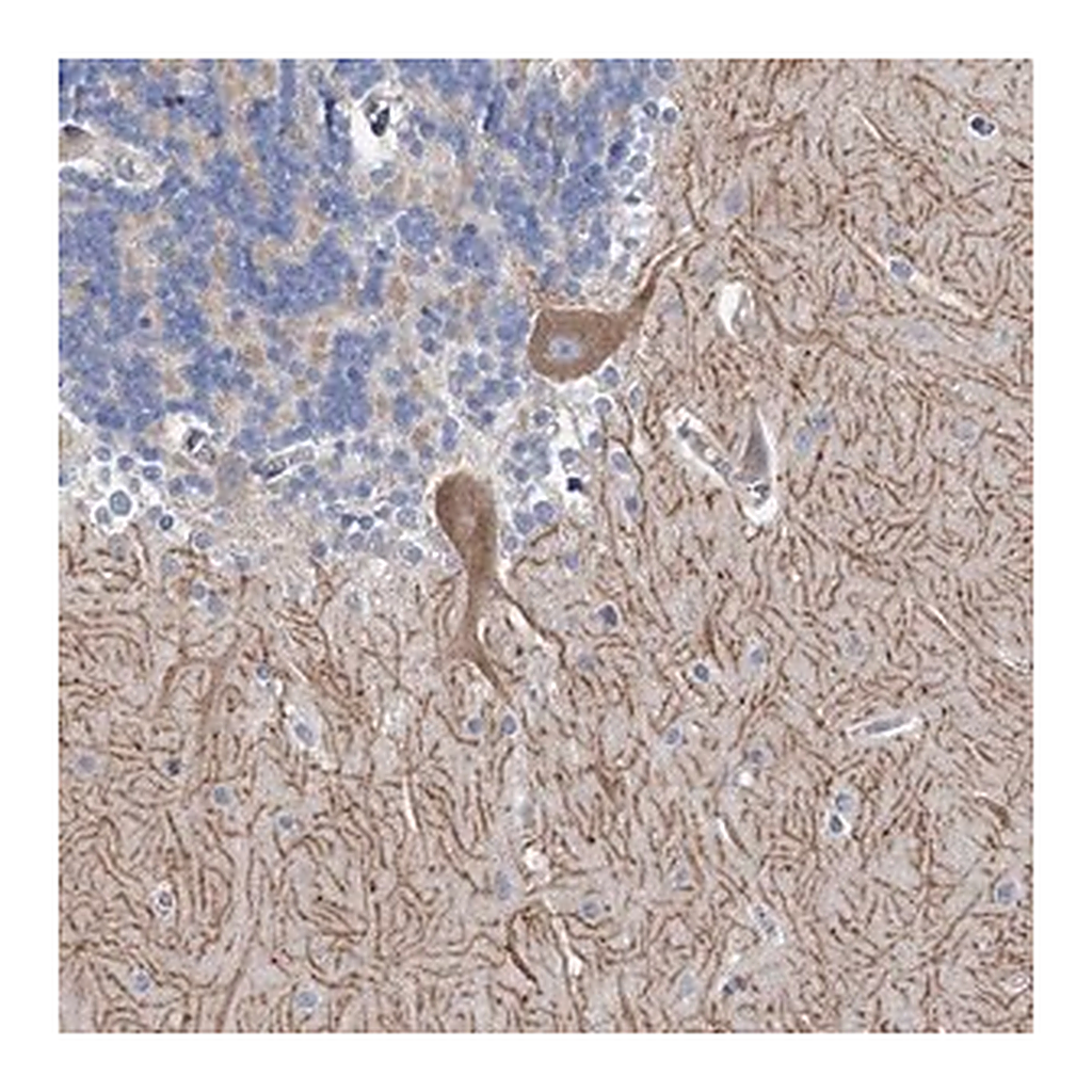 Merck Anti-ANKRD16 antibody produced in rabbit