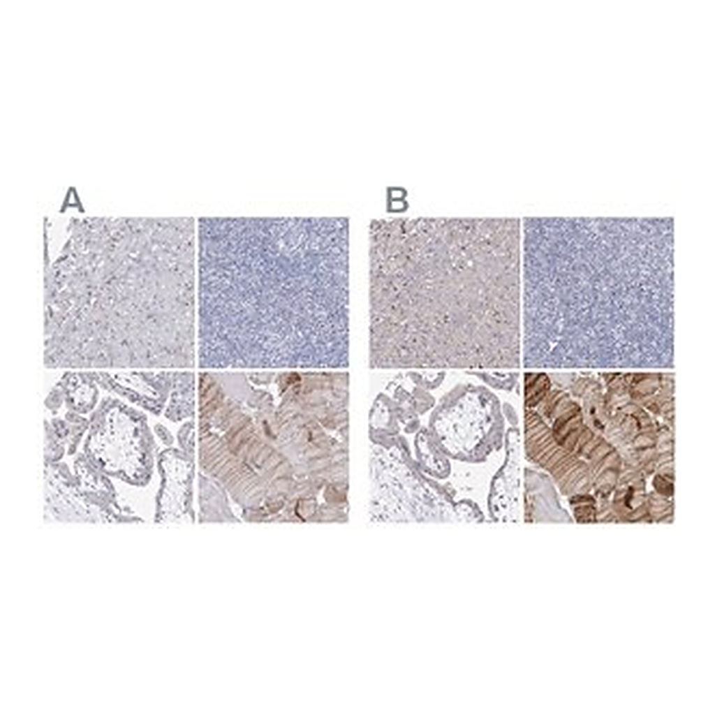 Merck Anti-NRAP antibody produced in rabbit