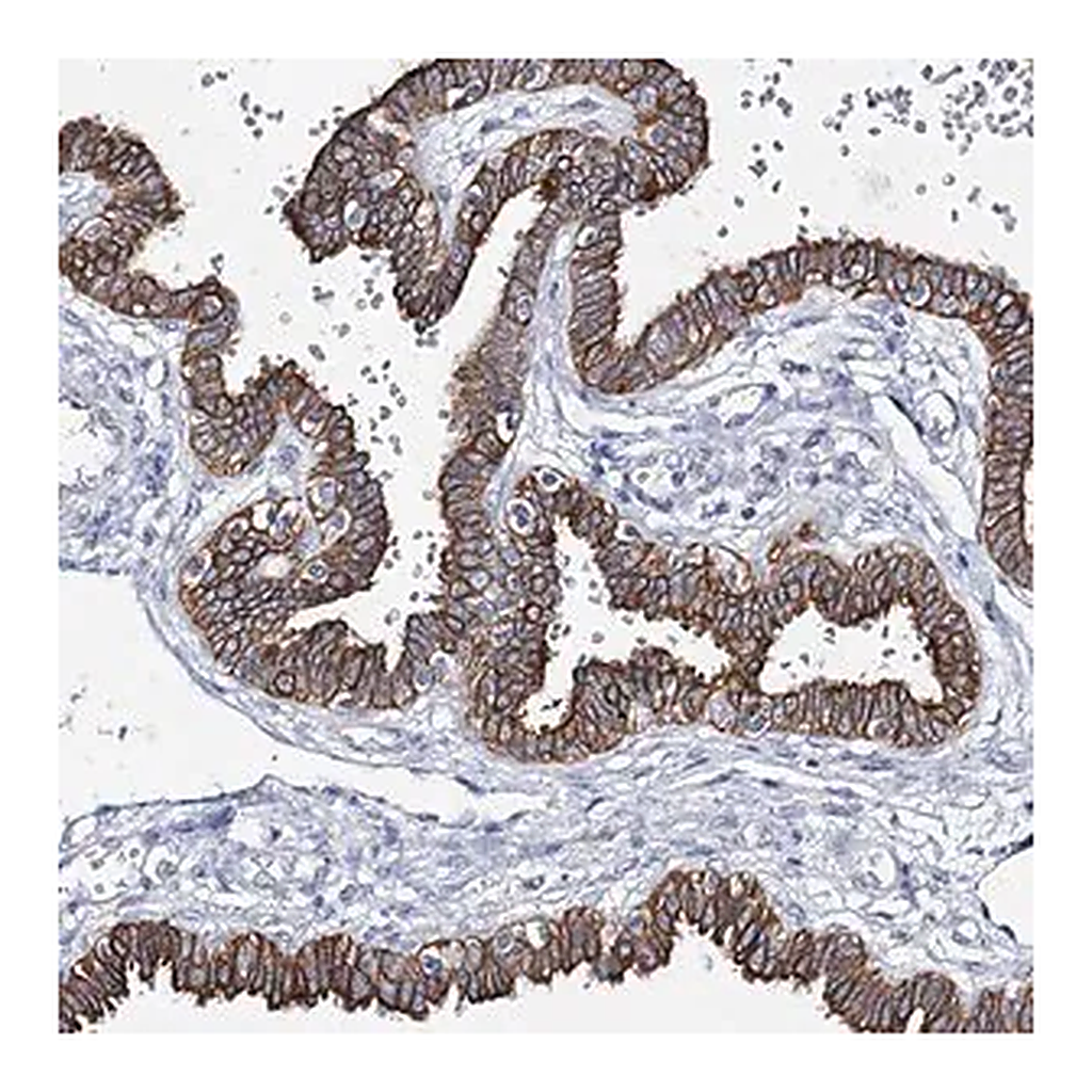 Merck Anti-ADGRL1 antibody produced in rabbit