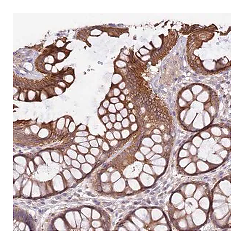 Merck Anti-VPS11 antibody produced in rabbit