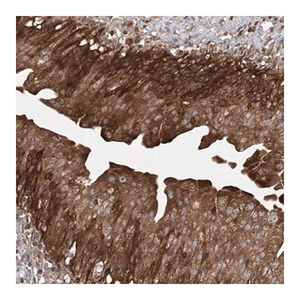 Merck Anti-ACAP2 antibody produced in rabbit