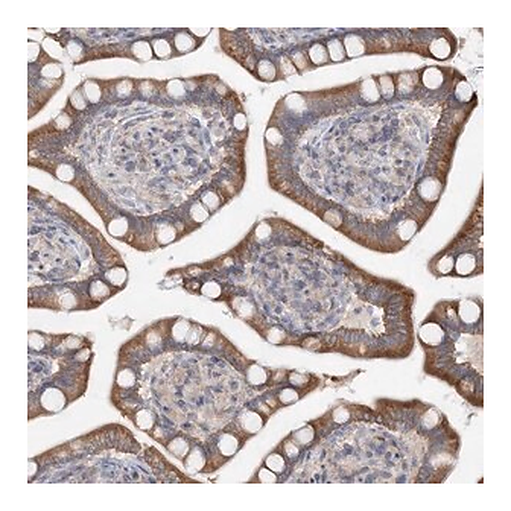 Merck Anti-FBXO38 antibody produced in rabbit