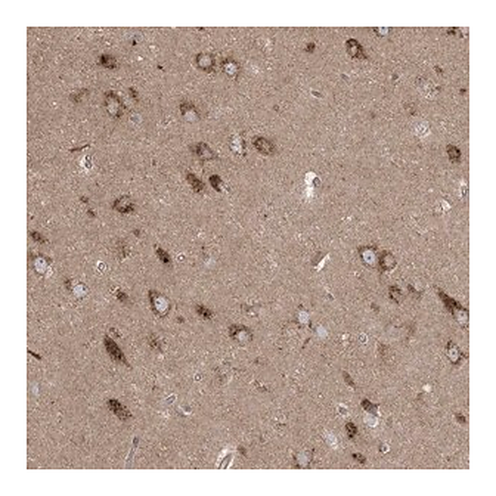 Merck Anti-KLHL18 antibody produced in rabbit