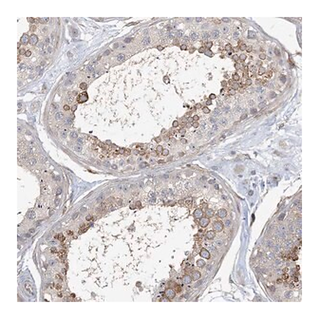 Merck Anti-MAP4K5 antibody produced in rabbit