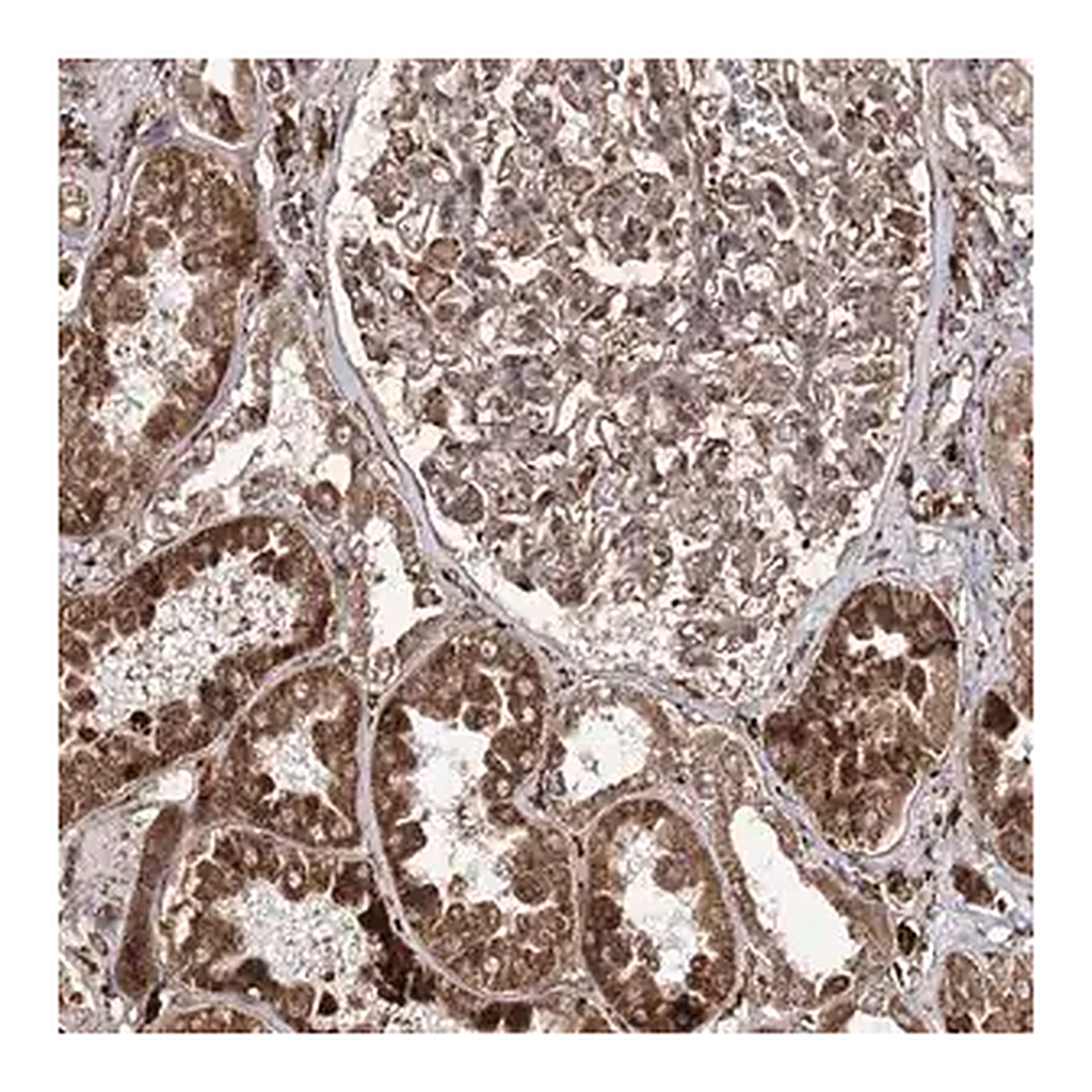 Merck Anti-FANCL antibody produced in rabbit